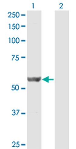 Invitrogen DPH2 Monoclonal Antibody (3F7) 100 &mu;g; Unconjugated:Antibodies,