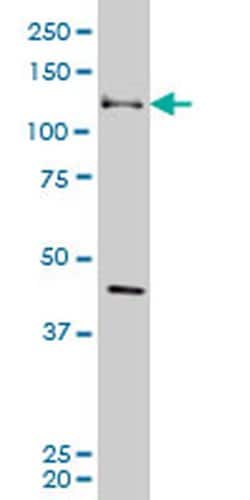 Invitrogen EphB3 Monoclonal Antibody (4E9) 100 &mu;g; Unconjugated:Antibodies,