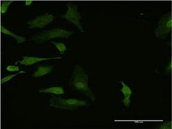 Invitrogen Hex Monoclonal Antibody (2B12) 100 &mu;g; Unconjugated:Antibodies,