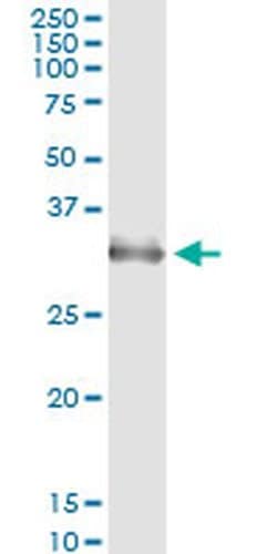 Invitrogen HOXA1/HOXB1/HOXD1 Monoclonal Antibody (2E5) 100 &mu;g; Unconjugated:Antibodies,