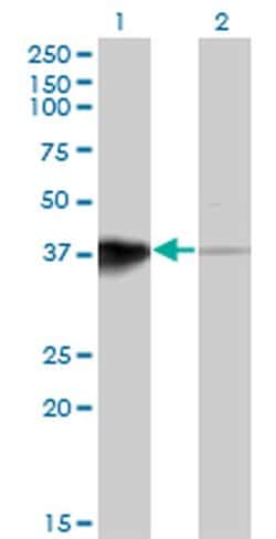 Invitrogen HOXB5 Monoclonal Antibody (3F10) 100 &mu;g; Unconjugated:Antibodies,
