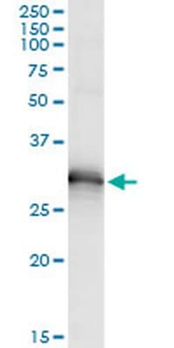 Invitrogen HOXB9 Monoclonal Antibody (2E8) 100 &mu;g; Unconjugated:Antibodies,
