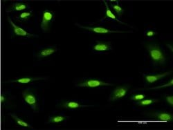 Invitrogen MCM3 Monoclonal Antibody (2H3) 100 &mu;g; Unconjugated:Antibodies,