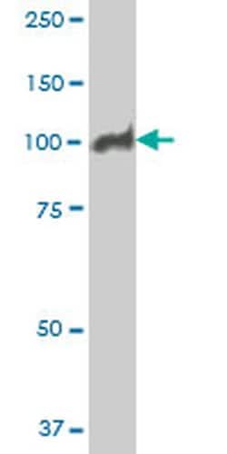 Invitrogen MCM3 Monoclonal Antibody (2H3) 100 &mu;g; Unconjugated:Antibodies,