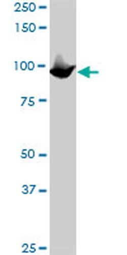 Invitrogen MCM3 Monoclonal Antibody (2H3) 100 &mu;g; Unconjugated:Antibodies,