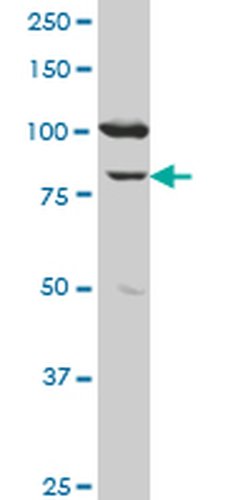 Invitrogen MCM3 Monoclonal Antibody (2H3) 100 &mu;g; Unconjugated:Antibodies,