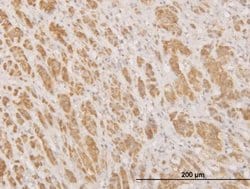 Invitrogen MPG Monoclonal Antibody (1G6) 100 &mu;g; Unconjugated:Antibodies,