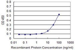 Invitrogen PHKG2 Monoclonal Antibody (2B8) 100 &mu;g; Unconjugated:Antibodies,
