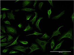 Invitrogen PHKG2 Monoclonal Antibody (2B8) 100 &mu;g; Unconjugated:Antibodies,