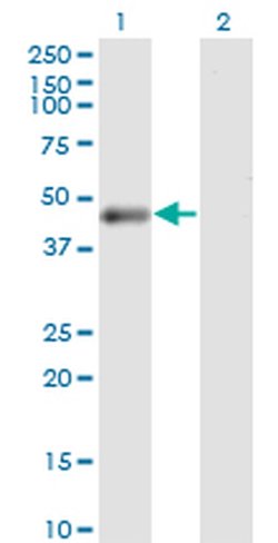 Invitrogen PHKG2 Monoclonal Antibody (2B8) 100 &mu;g; Unconjugated:Antibodies,