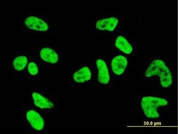 Invitrogen PKN1 Monoclonal Antibody (1B10) 100 &mu;g; Unconjugated:Antibodies,