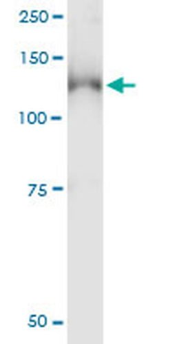 Invitrogen PKN1 Monoclonal Antibody (1B10) 100 &mu;g; Unconjugated:Antibodies,