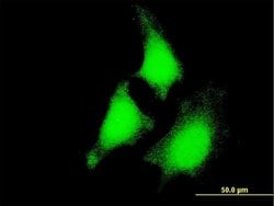 Invitrogen MEK5 Monoclonal Antibody (1E5) 100 &mu;g; Unconjugated:Antibodies,