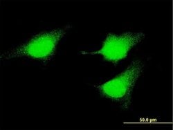 MEK5 Monoclonal Antibody (2C2):Antibodies, Monoclonal