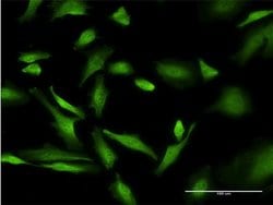 Invitrogen PURA Monoclonal Antibody (1D6) 100 &mu;g; Unconjugated:Antibodies,