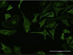 Invitrogen RPL32 Monoclonal Antibody (1B11) 100 &mu;g; Unconjugated:Antibodies,