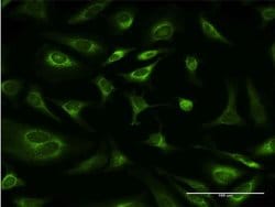 Invitrogen Ribophorin I Monoclonal Antibody (4B1-1E6) 100 &mu;g; Unconjugated:Antibodies,