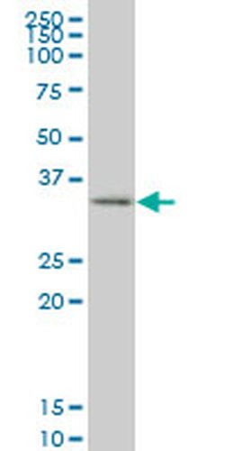 Invitrogen SIX3 Monoclonal Antibody (4H6) 100 &mu;g; Unconjugated:Antibodies,