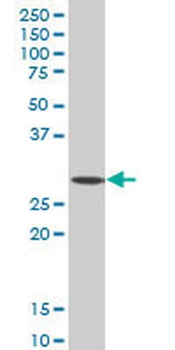 Invitrogen SIX3 Monoclonal Antibody (4H6) 100 &mu;g; Unconjugated:Antibodies,
