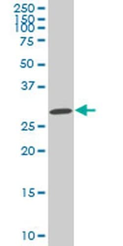 Invitrogen SIX3 Monoclonal Antibody (4H6) 100 &mu;g; Unconjugated:Antibodies,