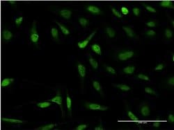 Invitrogen SNAPC4 Monoclonal Antibody (3F10) 100 &mu;g; Unconjugated:Antibodies,