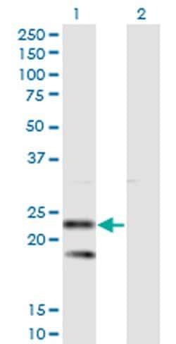 Invitrogen SSR2 Monoclonal Antibody (4C1) 100 &mu;g; Unconjugated:Antibodies,