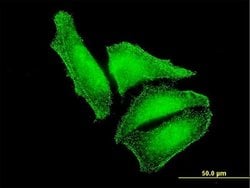 Invitrogen MST2 Monoclonal Antibody (1E9) 100 &mu;g; Unconjugated:Antibodies,