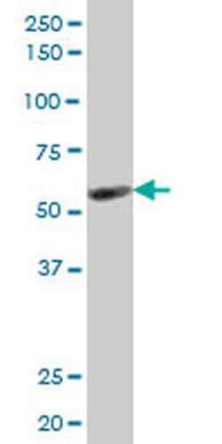 Invitrogen KLF10 Monoclonal Antibody (3E11) 100 &mu;g; Unconjugated:Antibodies,