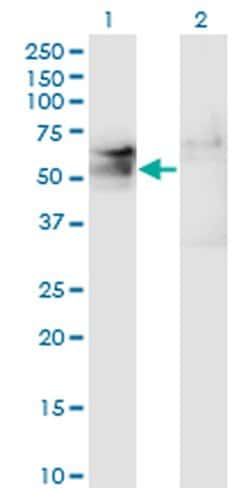 Invitrogen TSPYL1 Monoclonal Antibody (4F11) 100 &mu;g; Unconjugated:Antibodies,