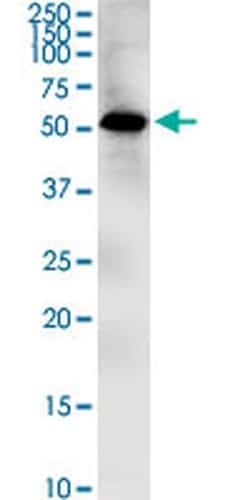Invitrogen ZIC1 Monoclonal Antibody (1A8) 100 &mu;g; Unconjugated:Antibodies,