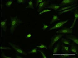 Invitrogen ZIC3 Monoclonal Antibody (2G1) 100 &mu;g; Unconjugated:Antibodies,
