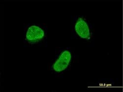 Invitrogen ZNF7 Monoclonal Antibody (6F2) 100 &mu;g; Unconjugated:Antibodies,