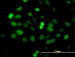 Invitrogen ZNF182 Monoclonal Antibody (6D11) 100 &mu;g; Unconjugated:Antibodies,