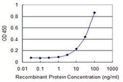Invitrogen ZKSCAN1 Monoclonal Antibody (2C7) 100 &mu;g; Unconjugated:Antibodies,