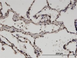 Invitrogen ZNF192 Monoclonal Antibody (3B10) 100 &mu;g; Unconjugated:Antibodies,