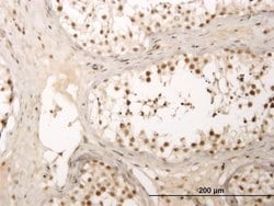 Invitrogen ZNF213 Monoclonal Antibody (5D7) 100 &mu;g; Unconjugated:Antibodies,