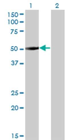Invitrogen ZNF213 Monoclonal Antibody (5D7) 100 &mu;g; Unconjugated:Antibodies,