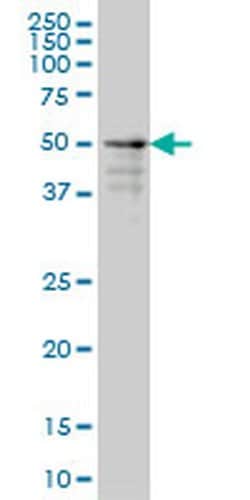 Invitrogen ZNF213 Monoclonal Antibody (5D7) 100 &mu;g; Unconjugated:Antibodies,