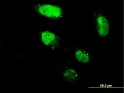 ZNF213 Monoclonal Antibody (3D3):Antibodies, Monoclonal