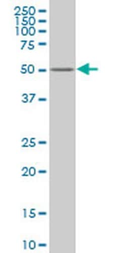 ZNF213 Monoclonal Antibody (3D3):Antibodies, Monoclonal