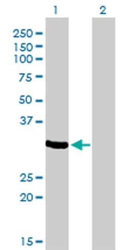 Invitrogen ZNF215 Monoclonal Antibody (2C11) 100 &mu;g; Unconjugated:Antibodies,