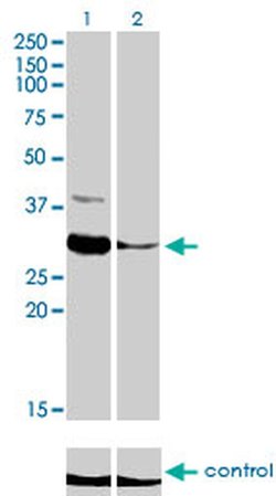 Invitrogen ZNF215 Monoclonal Antibody (2C11) 100 &mu;g; Unconjugated:Antibodies,