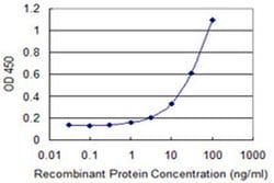 Invitrogen ZNF232 Monoclonal Antibody (1F8) 100 &mu;g; Unconjugated:Antibodies,