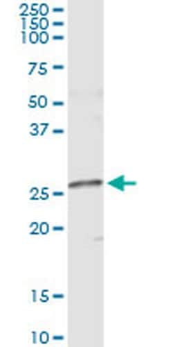 NME5 Monoclonal Antibody (4F5):Antibodies, Monoclonal