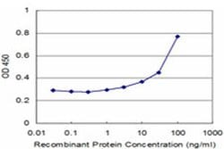 4E-BP3 Monoclonal Antibody (1E3):Antibodies, Monoclonal