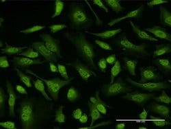 4E-BP3 Monoclonal Antibody (1E3):Antibodies, Monoclonal