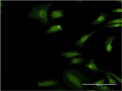 Invitrogen eIF3i Monoclonal Antibody (3B10) 100 &mu;g; Unconjugated:Antibodies,