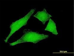 Invitrogen GANP Monoclonal Antibody (1H3) 100 &mu;g; Unconjugated:Antibodies,