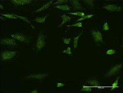 EMAP II Monoclonal Antibody (1C11):Antibodies, Monoclonal