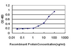 Invitrogen PIGL Monoclonal Antibody (2B6) 100 &mu;g; Unconjugated:Antibodies,